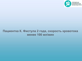 Пациентка К. Фистула 2 года, скорость кровотока
менее 100 мл/мин
 