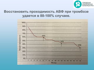 Восстановить проходимость АВФ при тромбозе
удается в 88-100% случаев.
 
