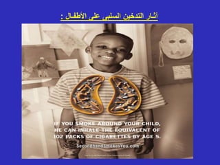 ‫األطفـال‬ ‫على‬ ‫السلبى‬ ‫التدخين‬ ‫آثـار‬
:
 