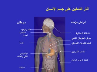 ‫اإلنسان‬ ‫جسم‬ ‫على‬ ‫التدخين‬ ‫آثار‬
‫سرطان‬
‫الرئة‬
‫الحنجرة‬
‫المرئ‬
‫المثانة‬
‫والحالب‬ ‫الكلي‬
‫البنكرياس‬
‫والبلعوم‬ ‫الفم‬
‫الدماغية‬ ‫السكتة‬
‫التاجي‬ ‫الشريان‬ ‫مرض‬
‫األورطي‬ ‫الشريان‬ ‫تمدد‬
‫الشرايين‬ ‫تصلب‬
‫المزمن‬ ‫الرئوى‬ ‫التمدد‬
‫مزمنة‬ ‫أمراض‬
 