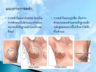  การคลาในแนวก้นหอย โดยเริ่ม
จากส่วนบนไปตามแนวก้นหอย
จนกระทั่งถึงฐานเต้านมบริเวณ
รักแร้
 การคลาในแนวรูปลิ่ม เริ่มจาก
ส่วนบนของเต้านมจนถึงฐานแล้ว
กลับสู่ยอดอย่างนี้ไปเรื่อยๆให้ทั่ว
ทั้งเต้านม
 
