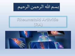 ‫الرحيم‬‫الرحمن‬ ‫هللا‬ ‫بسم‬
Rheumatoid Arthritis
(RA)
 