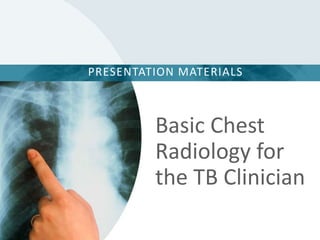 Basic Chest
Radiology for
the TB Clinician
PRESENTATION MATERIALS
 