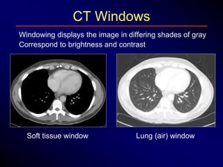 Window Ring Ct первая лекция иностр.pptx