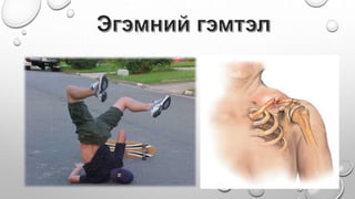 Бэртэл гэмтлийн үеийн тусламж Насандэлгэр Ариунзаяа Балдандорж.pptx