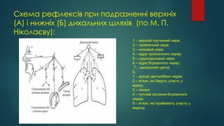Схема рефлексів при подразненні верхніх
(А) і нижніх (Б) дихальних шляхів (по М. П.
Ніколаєву):
1 – верхній гортанний нерв;
2 – тройничний нерв;
3 – нюховий нерв;
4 – ядра тройничного нерву;
5 – судиноруховий нерв;
6 – ядра блукаючого нерву;
7 – дихальний центр.
Б.
1 – рухові центробіжні нерви
2 – м’язи, які беруть участь у
вдиху;
3 – легені;
4 – чутливі волокна блукаючого
нерва;
5 – м’язи, які приймають участь у
видоху.
 