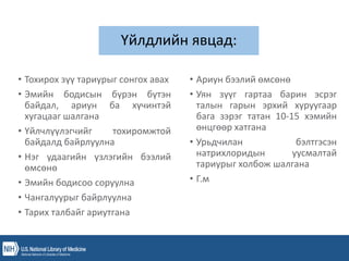 Үйлдлийн явцад:
• Тохирох зүү тариурыг сонгох авах
• Эмийн бодисын бүрэн бүтэн
байдал, ариун ба хүчинтэй
хугацааг шалгана
• Үйлчлүүлэгчийг тохиромжтой
байдалд байрлуулна
• Нэг удаагийн үзлэгийн бээлий
өмсөнө
• Эмийн бодисоо соруулна
• Чангалуурыг байрлуулна
• Тарих талбайг ариутгана
• Ариун бээлий өмсөнө
• Уян зүүг гартаа барин эсрэг
талын гарын эрхий хуруугаар
бага зэрэг татан 10-15 хэмийн
өнцгөөр хатгана
• Урьдчилан бэлтгэсэн
натрихлоридын уусмалтай
тариурыг холбож шалгана
• Г.м
 