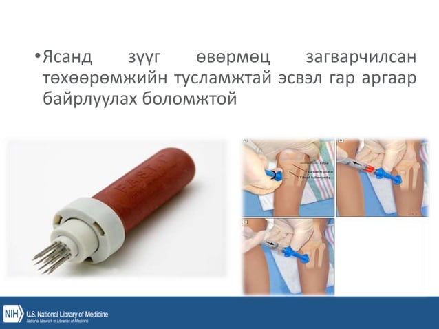уян зүү, ясны хатгалт, шингэн сэлбэлт.pptx