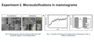 Experiment 2. Microcalcifications in mammograms
Fig 4. Mammograms with the absence (left) and with
presence (right) of microcalcifications.
Fig 11. Results of training and testing with mammograms with or
without calcifications.
 