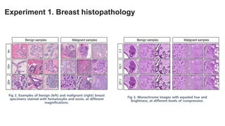 Experiment 1. Breast histopathology
Fig 2. Examples of benign (left) and malignant (right) breast
specimens stained with hematoxylin and eosin, at different
magnifications.
Fig 3. Monochrome images with equated hue and
brightness, at different levels of compression.
 