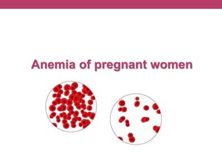 Anemia of pregnant women
 