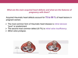 What are the main acquired heart defects and what are the features of
pregnancy with them?
Acquired rheumatic heart defects account for 75 to 90 % of heart lesions in
pregnant women.
 The most common form of rheumatic heart disease is mitral stenosis
"pure" or predominant
 The second most common defect (6-7%) is mitral valve insufficiency.
 Mitral valve prolapse.
 