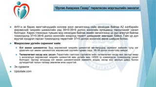 “Өргөө Амаржих Газар” төрөлжсөн мэргэшлийн эмнэлэг
 АНУ-н эх барих эмэгтэйчүүдийн коллеж хоол эмчилгээнд сайн хянагдаж байгаа А2 хэлбэрийн
жирэмсний чихрийн шижингийн үед 39+0-39+6 долоо хоногийн хугацаанд төрүүлэхийг санал
болгодог. Харин глюкозын түвшин муу хянагдаж байгаа эмийн эмчилгээнд үр дүн өгөхгүй байгаа
тохиолдолд 37+0-38+6 долоо хоногийн хооронд төрөлт шийдэхийг зөвлөдөг байна. Гэвч үр дүн
муутай хүндрэл гарсан тохиолдолд төрөлтийг 37+0 долоо хоногоос өмнө шийдэж болно.
 Макросоми ургийн скрининг хийх
 Хэт авиан шинжилгээ: Бид жирэмсний чихрийн шижинтэй өвчтөнүүдэд скрининг хийхийн тулд нэг
удаагийн хэт авиан шинжилгээг жирэмсний сүүлийн гурван сард 36-39 долоо хоногтойд хийдэг.
 Төлөвлөгөөт кесар мэс засал- Төрөлтийн гэмтлээс сэргийлж хийх төлөвлөгөөт кесар мэс заслыг ямар
ч ангилалын жирэмсний чихрийн шижинтэй мөн ургийн жин >4500 гр хэмжигдсэн тохиолдолд санал
болгодог. Эдгээр эхчүүдэд хэт авиан шинжилгээний хэмжилт, алдаа, кесар мэс заслын давуу болон
дутагдалтай талын талаар зөвлөгөө өгөх хэрэгтэй.
 Эх сурвалж
 Uptodate.com
 