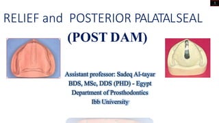 RELIEF and POSTERIOR PALATALSEAL
(POST DAM)
Assistant professor: Sadeq Al-tayar
BDS, MSc, DDS (PHD) - Egypt
Department of Prosthodontics
Ibb University
1
 
