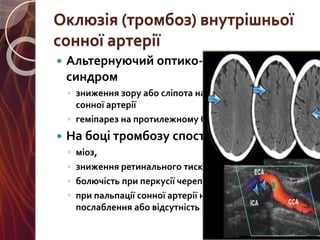 Комп’ютерна томограма
 Вогнище ішемії у
правій потиличній
частці (басейн задньої
мозкової артерії)
 