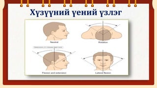 Үений асуумж, бодит үзлэг.pptx