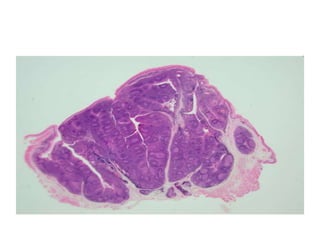Large intestine
• No plicae folds!
• No Villi!
• No paneth cells
• Many goblet cells
• Solitary lymphoid follicles
• Crypt...