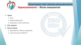“Өргөө Амаржих Газар” төрөлжсөн мэргэшлийн эмнэлэг
Хориоамнионит - Ялган оношилгоо
 Төрөлт
 Fever
 Maternal tachycardia,
 leukocytosis, uterine tenderness.
 Ихэс ховхролт
 Бусад халдвар
 pyelonephritis, influenza, appendicitis,
 pneumonia, болон COVID-19
 