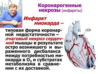 Коронарогенные
некрозы (инфаркты)
Инфаркт
миокарда –
типовая форма коронар-
ной недостаточности –
очаговый некроз сердеч-
...