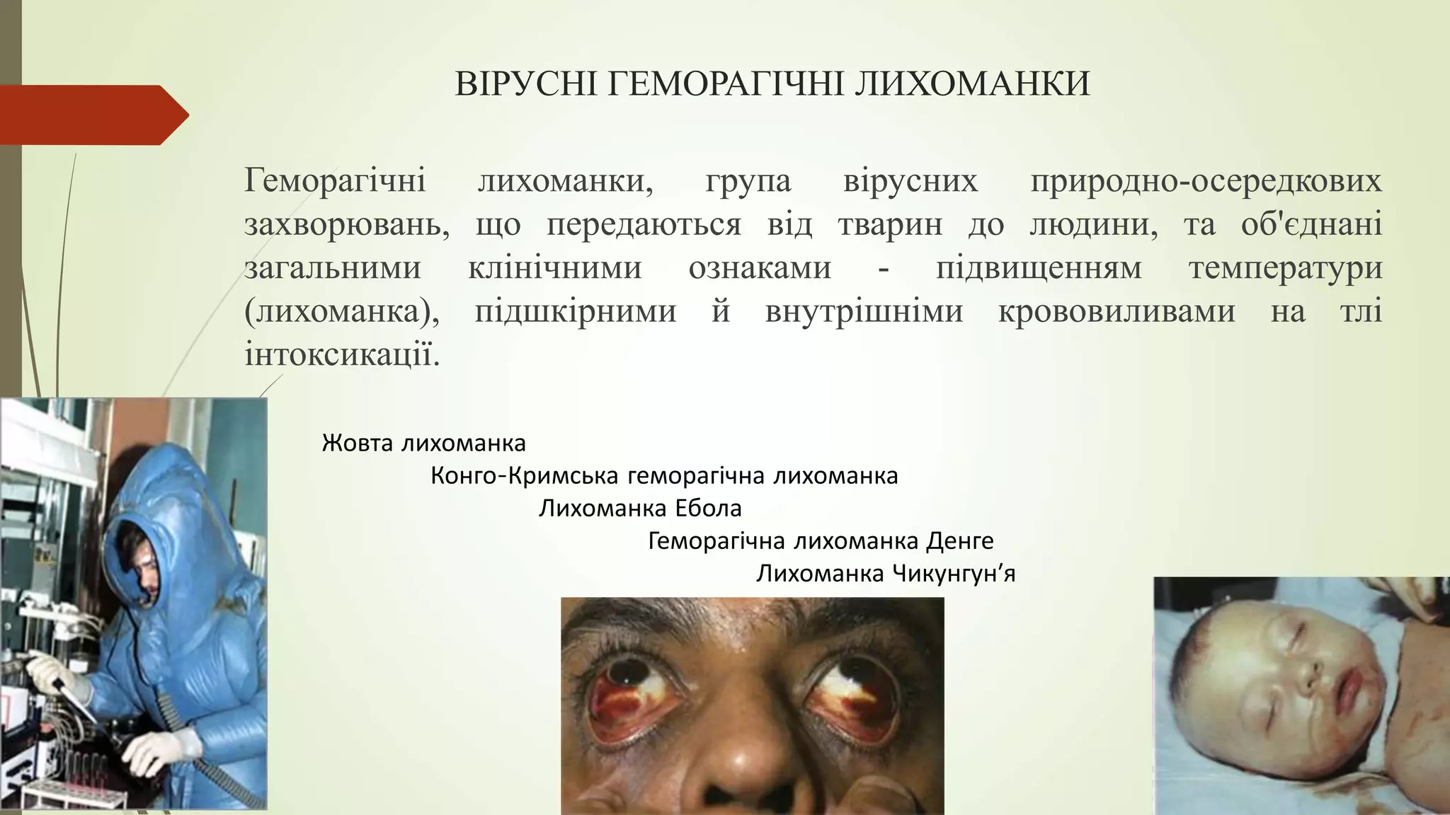 ВІРУСНІ ГЕМОРАГІЧНІ ЛИХОМАНКИ
Геморагічні лихоманки, група вірусних природно-осередкових
захворювань, що передаються від тварин до людини, та об'єднані
загальними клінічними ознаками - підвищенням температури
(лихоманка), підшкірними й внутрішніми крововиливами на тлі
інтоксикації.
Жовта лихоманка
Конго-Кримська геморагічна лихоманка
Лихоманка Ебола
Геморагічна лихоманка Денге
Лихоманка Чикунгун′я
 