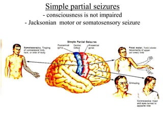 Simple partial seizures
- consciousness is not impaired
- Jacksonian motor or somatosensory seizure
 
