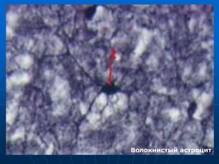 Волокнистый астроцит
 