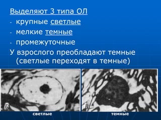 Выделяют 3 типа ОЛ
- крупные светлые
- мелкие темные
- промежуточные
У взрослого преобладают темные
(светлые переходят в темные)
светлые темные
 