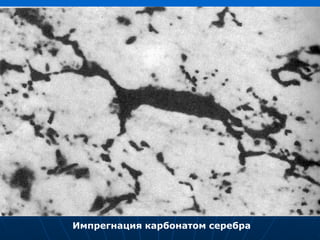 Импрегнация карбонатом серебра
 