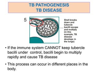 TB PATHOGENESIS
TB DISEASE
Shell breaks
down and
tubercle
bacilli escape
and multiply
(in this
example, TB
disease
develops in
the lungs)
5
• If the immune system CANNOT keep tubercle
bacilli under control, bacilli begin to multiply
rapidly and cause TB disease
• This process can occur in different places in the
body.
 