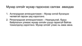 Мухар олгойг мухар гэдэснээс салгаж авахдаа
1. Антеградная аппендэктомия – Мухар олгой бүхэлдээ
чөлөөтэй гарсан үед хэрэглэнэ.
2. Ретроградная аппендэктомия – Наалдацтай, буруу
байрлалын улмаас мухар олгойн үзүүр гарахгүй байгаа
тохиолдолд хэрэглэнэ. Мухар олгойг угаас нь хөөж авна.
 