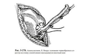 МУХАР ОЛГОЙН ҮРЭВСЭЛ.pptx