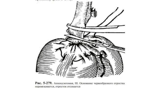 МУХАР ОЛГОЙН ҮРЭВСЭЛ.pptx