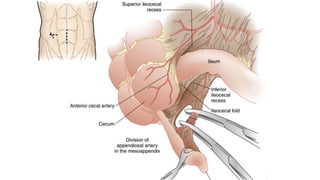 МУХАР ОЛГОЙН ҮРЭВСЭЛ.pptx