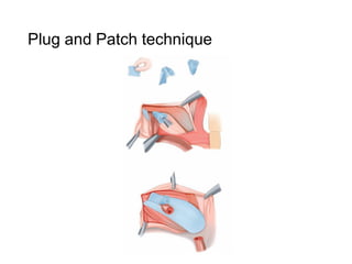 Plug Patch Rasp Ивэрхий.pdf
