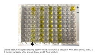 Giardia II ELISA microplate showing positive results in columns 3 (House of Ahiel, black arrow), and 5, 7,
9 (Armon ha-Natziv, white arrows). Image credit: Piers Mitchell.
 