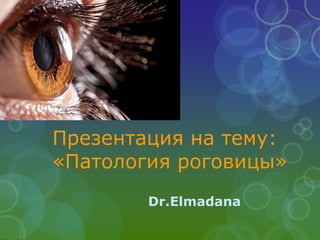 Презентация на тему:
«Патология роговицы»
Dr.Elmadana
 