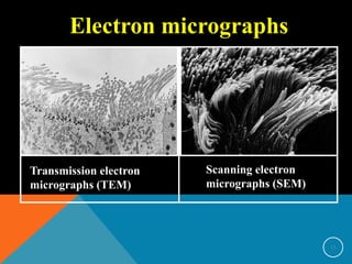 Electron micrographs
Transmission electron
micrographs (TEM)
Scanning electron
micrographs (SEM)
15
 