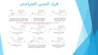 ‫الجراحي‬ ‫اليدين‬ ‫فرك‬
 