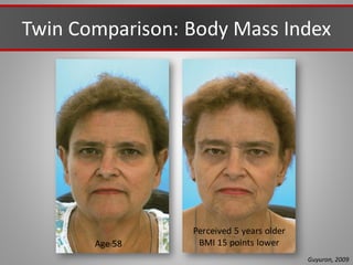 Twin Comparison: Body Mass Index
Guyuron, 2009
Age 58
Perceived 5 years older
BMI 15 points lower
 