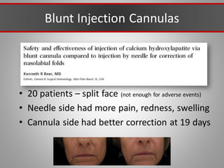 Blunt Injection Cannulas
• 20 patients – split face (not enough for adverse events)
• Needle side had more pain, redness, swelling
• Cannula side had better correction at 19 days
 