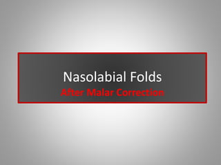 Nasolabial Folds
After Malar Correction
 