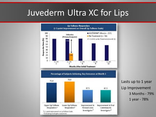 Juvederm Ultra XC for Lips
Lasts up to 1 year
Lip Improvement
3 Months - 79%
1 year - 78%
 