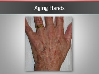 Aging Hands
 