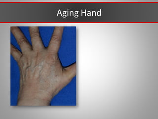 Aging Hand
 