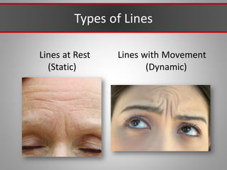 Types of Lines
Lines at Rest
(Static)
Lines with Movement
(Dynamic)
 