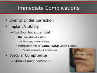 Immediate Complications
• Over or Under Correction
• Implant Visibility
– Injection too superficial
• HA blue discoloration
– Massage, Hyaluronidase
• Particulate fillers (CaHA, PMM) white bumps
– Needle unroofing & evacuation
• Vascular Compromise
– Glabella most common?
Reticulated Duskiness
 