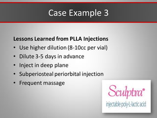 Case Example 3
Lessons Learned from PLLA Injections
• Use higher dilution (8-10cc per vial)
• Dilute 3-5 days in advance
• Inject in deep plane
• Subperiosteal periorbital injection
• Frequent massage
 
