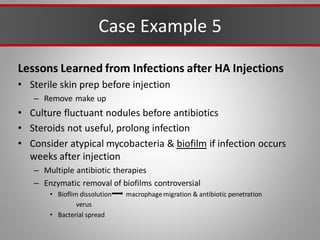 Case Example 5
Lessons Learned from Infections after HA Injections
• Sterile skin prep before injection
– Remove make up
• Culture fluctuant nodules before antibiotics
• Steroids not useful, prolong infection
• Consider atypical mycobacteria & biofilm if infection occurs
weeks after injection
– Multiple antibiotic therapies
– Enzymatic removal of biofilms controversial
• Bioflim dissolution macrophagemigration & antibiotic penetration
verus
• Bacterial spread
 