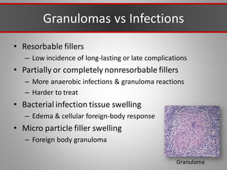 Granulomas vs Infections
• Resorbable fillers
– Low incidence of long-lasting or late complications
• Partially or completely nonresorbable fillers
– More anaerobic infections & granuloma reactions
– Harder to treat
• Bacterial infection tissue swelling
– Edema & cellular foreign-body response
• Micro particle filler swelling
– Foreign body granuloma
Granuloma
 