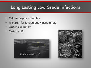 Long Lasting Low Grade Infections
• Culture negative nodules
• Mistaken for foreign-body granulomas
• Bacteria in biofilm
• Cysts on US
Cystic lesion in NLF Bacteria in Biofilm
 